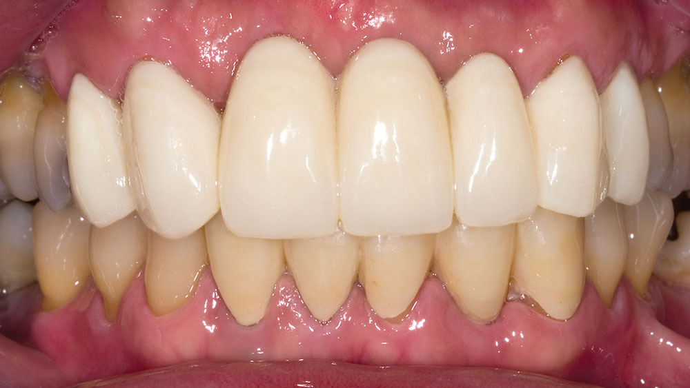 cm0201biotempsprovisionals20