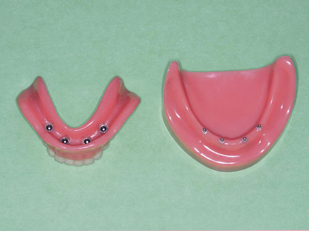 im0201truthimplants02