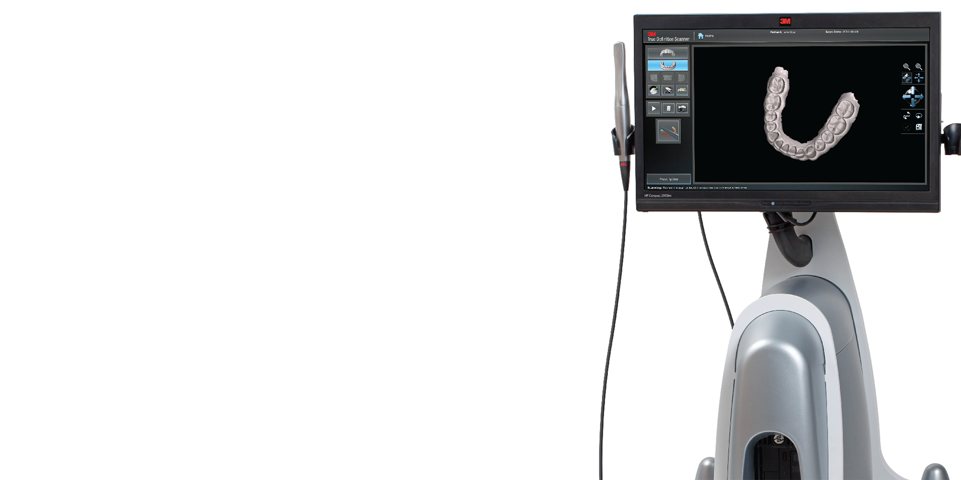 im0501digitalimpressionsystemshd.