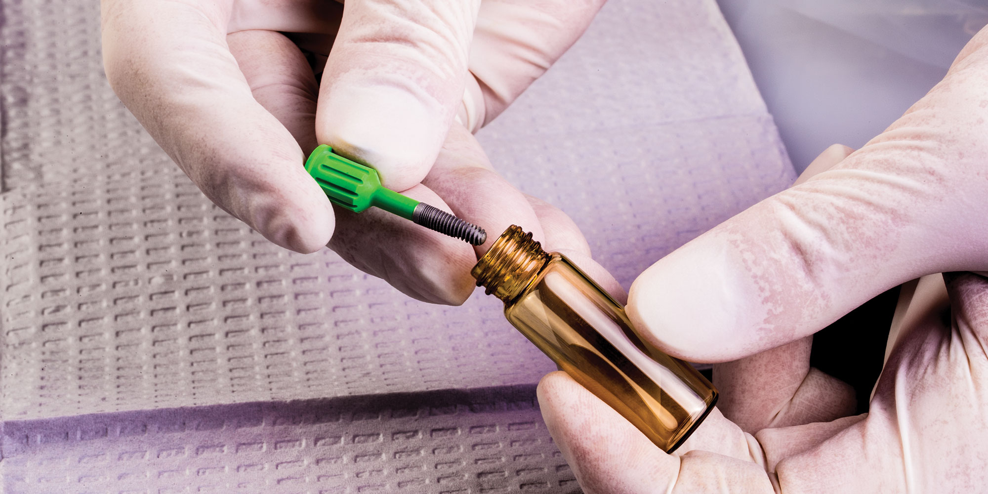 Learn to Place Implants Five Pointers for GPs