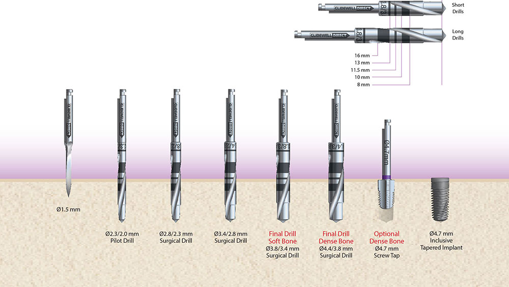 im0303drillingprotocol02.